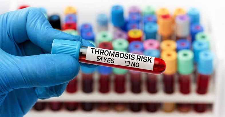 thrombosis_risk_image_resize