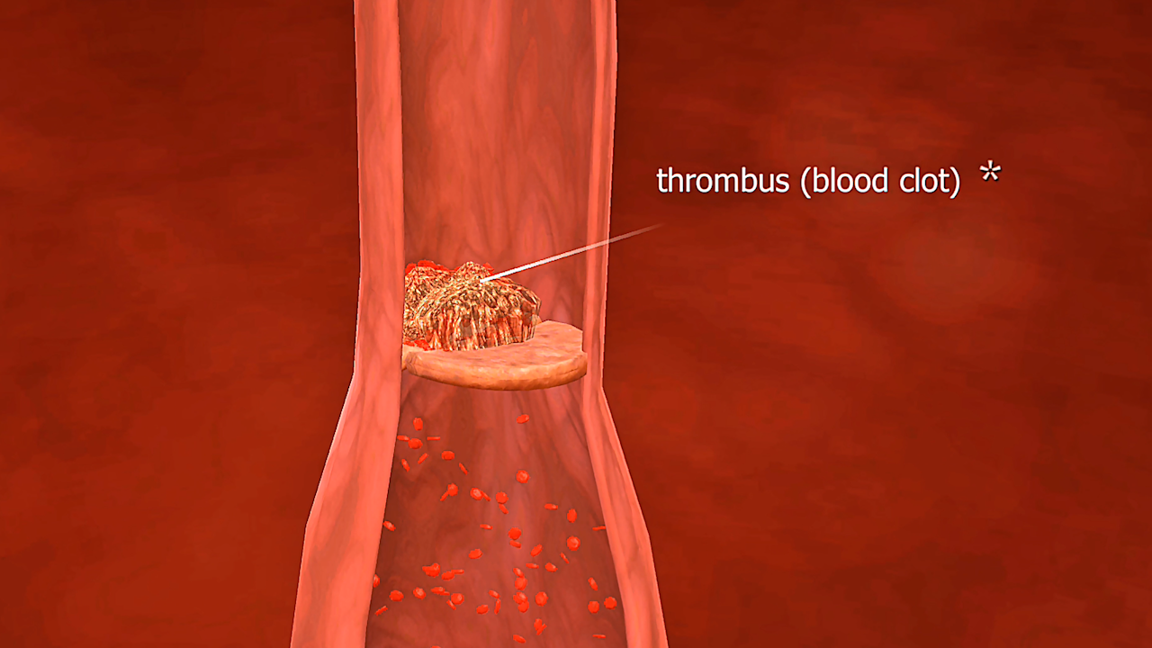 auto accidents image